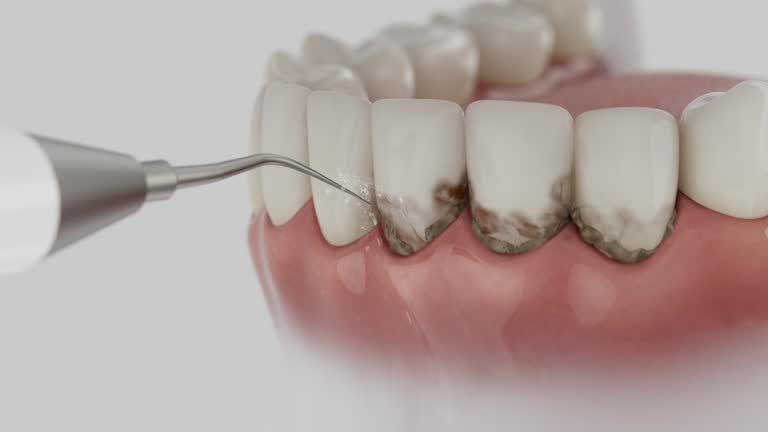 Reliable Teeth Cleaning And Checkup contractor in Fairfax County County, VA by Dentist Open Now